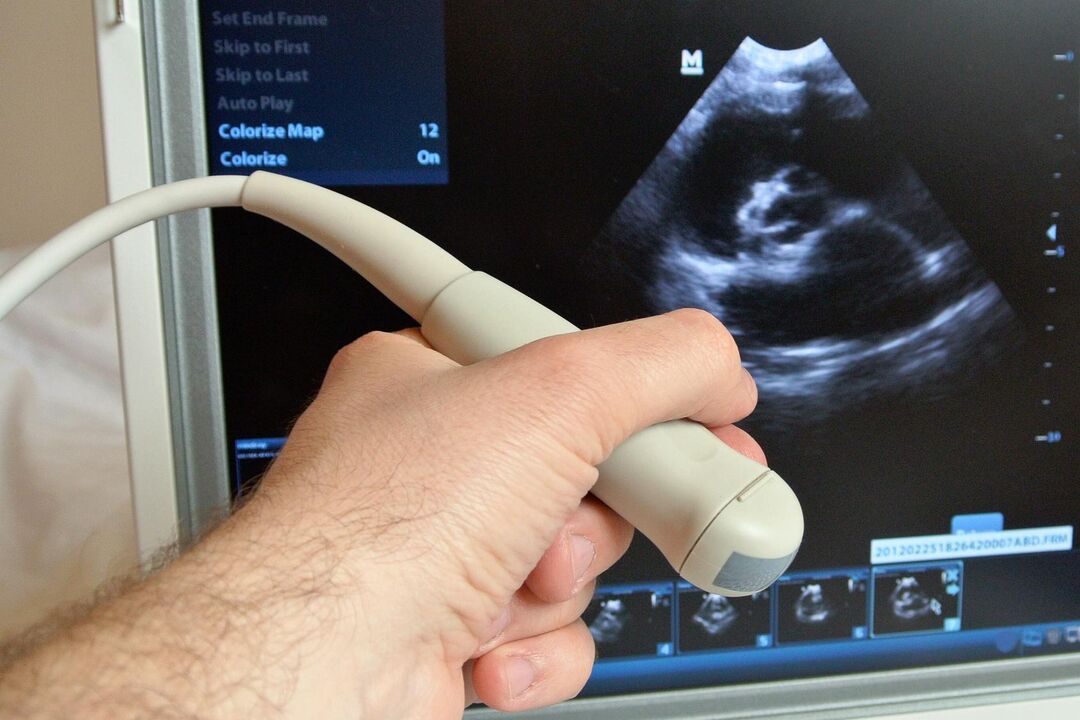 Ang ultratunog ay makakatulong sa pag-diagnose ng congestive prostatitis sa isang lalaki