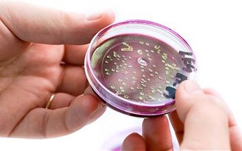 Bakterya sa pagtatago ng prosteyt